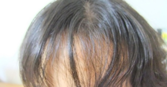 くせ毛を治す方法とは 意識すべきはシャンプー ドライヤー 逆にくせ毛を生かした髪型がこちら 100テク